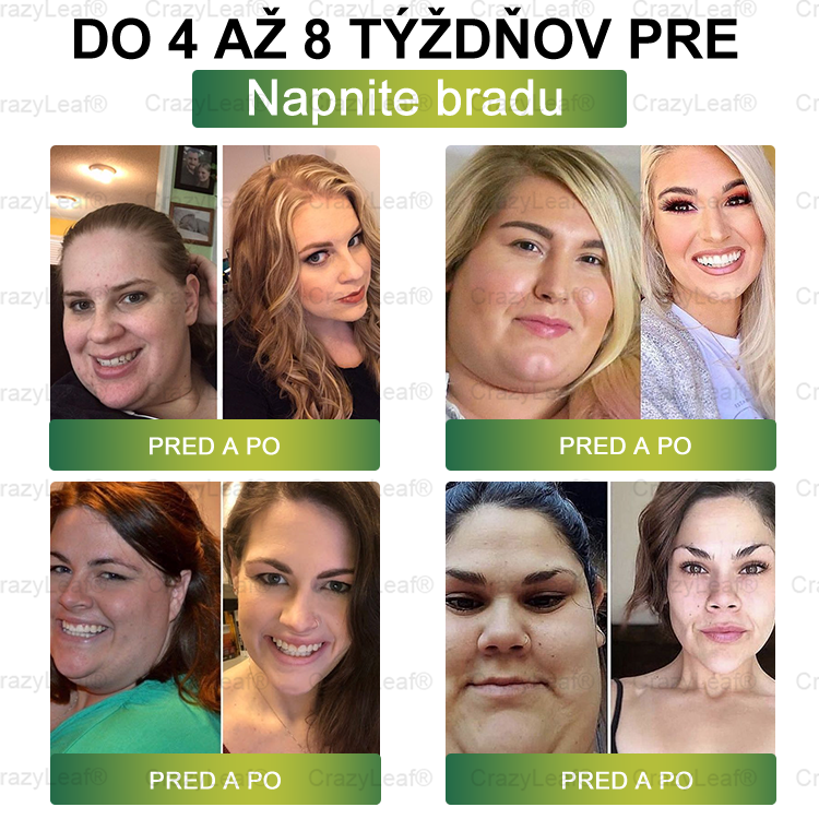 CrazyLeaf® Meglutide GLP-1 aktivačný perorálny roztok - Moringa • NAD+ • Yerba Maté - prírodná podpora chudnutia, proti starnutiu a metabolizmu cukru