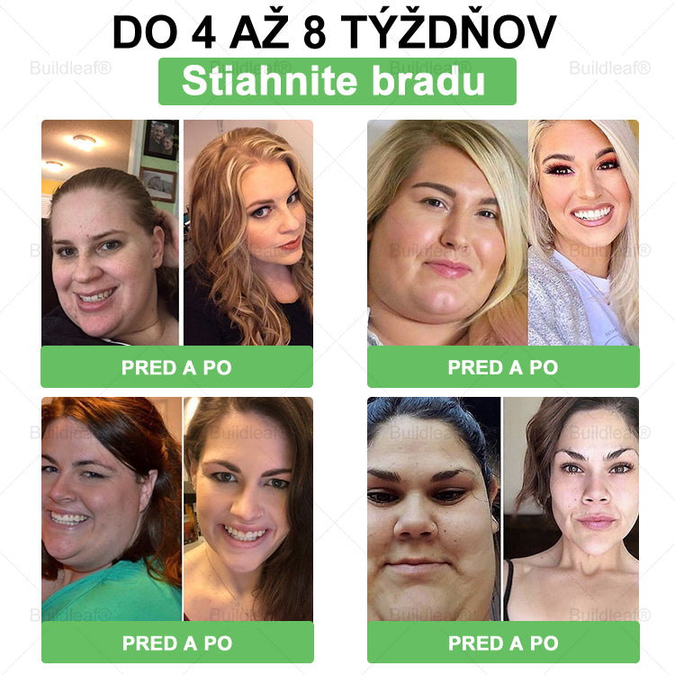 BuildLeaf® GLP-1 6-v-1 Health Solution Perorálna tekutina (Len raz denne, viditeľné zmeny už za 7 dní) Pre obezitu, kardiovaskulárne ochorenia, cukrovku, spánkové apnoe, zdravie čriev, problémy s kĺbmi a ďalšie