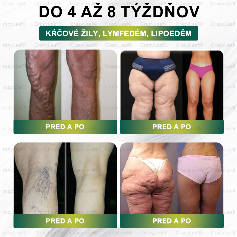 CrazyLeaf® Meglutide GLP-1 aktivačný perorálny roztok - Moringa • NAD+ • Yerba Maté - prírodná podpora chudnutia, proti starnutiu a metabolizmu cukru