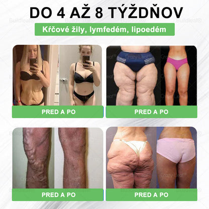 BuildLeaf® GLP-1 6-v-1 Health Solution Perorálna tekutina (Len raz denne, viditeľné zmeny už za 7 dní) Pre obezitu, kardiovaskulárne ochorenia, cukrovku, spánkové apnoe, zdravie čriev, problémy s kĺbmi a ďalšie