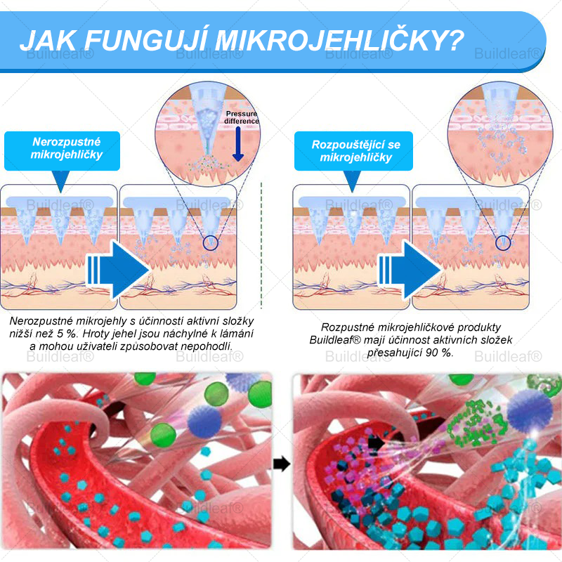 🏥Oficiálny obchod | Náplasť BuildLeaf® GLP-1 s nano-mikroihličkami, kolagénom a Matrixylom 3000 pre obezitu, kardiovaskulárne ochorenia, cukrovku, spánkové apnoe, problémy s kĺbmi a ďalšie