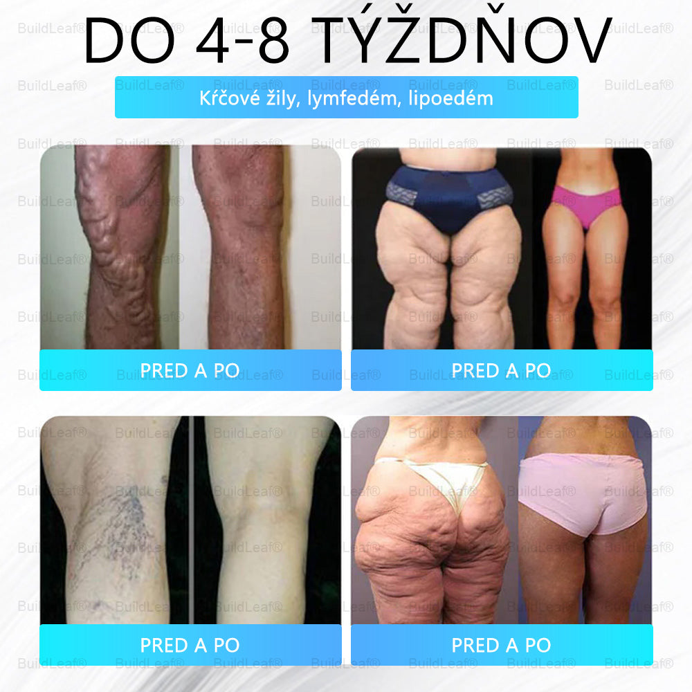🏥Oficiálny obchod | Náplasť BuildLeaf® GLP-1 s nano-mikroihličkami, kolagénom a Matrixylom 3000 pre obezitu, kardiovaskulárne ochorenia, cukrovku, spánkové apnoe, problémy s kĺbmi a ďalšie