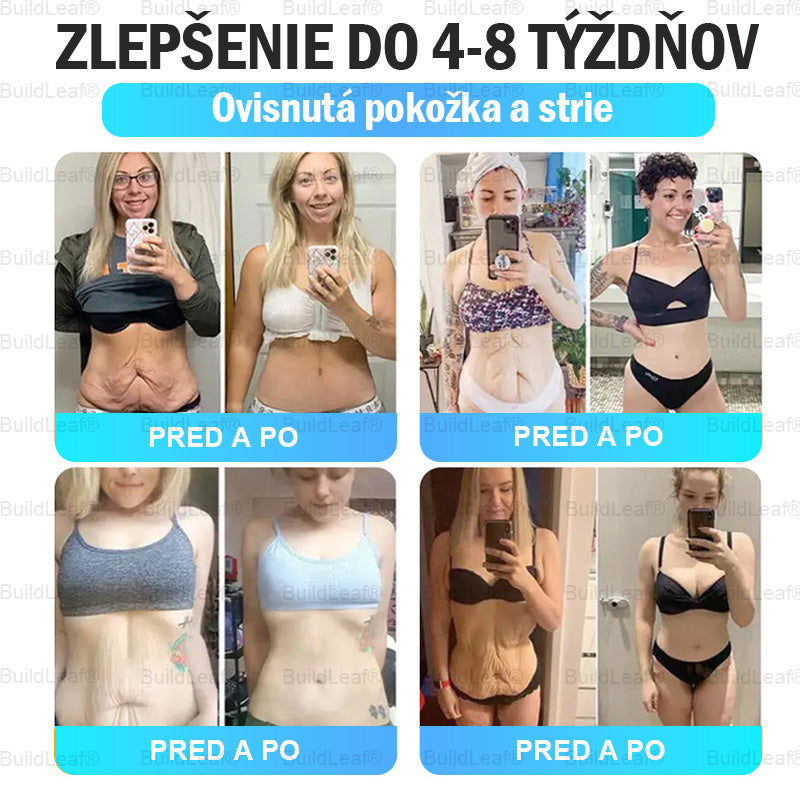 🏥Oficiálny obchod | Náplasť BuildLeaf® GLP-1 s nano-mikroihličkami, kolagénom a Matrixylom 3000 pre obezitu, kardiovaskulárne ochorenia, cukrovku, spánkové apnoe, problémy s kĺbmi a ďalšie