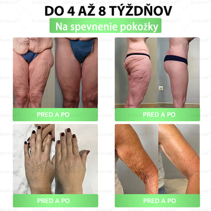 🖤 𝓑𝓵𝓪𝓬𝓴 𝓕𝓻𝓲𝓭𝓪𝔂 | 𝓑𝓾𝓲𝓵𝓭𝓛𝓮𝓪𝓯® 𝓖𝓛𝓟-1 8-𝓿-1 𝓢𝓵𝓲𝓶 & 𝓗𝓮𝓪𝓵𝓽𝓱𝔂 𝓞𝓻á𝓵𝓷𝓮 𝓻𝓲𝓮š𝓮𝓷𝓲𝓮(Stačí raz denne, výsledky vidno už za 7 dní)✅ Pomáha pri obezite, srdci, cukrovke, spánkovom apnoe, trávení aj kĺboch