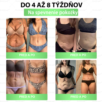 🖤 𝓑𝓵𝓪𝓬𝓴 𝓕𝓻𝓲𝓭𝓪𝔂 | 𝓑𝓾𝓲𝓵𝓭𝓛𝓮𝓪𝓯® 𝓖𝓛𝓟-1 8-𝓿-1 𝓢𝓵𝓲𝓶 & 𝓗𝓮𝓪𝓵𝓽𝓱𝔂 𝓞𝓻á𝓵𝓷𝓮 𝓻𝓲𝓮š𝓮𝓷𝓲𝓮(Stačí raz denne, výsledky vidno už za 7 dní)✅ Pomáha pri obezite, srdci, cukrovke, spánkovom apnoe, trávení aj kĺboch